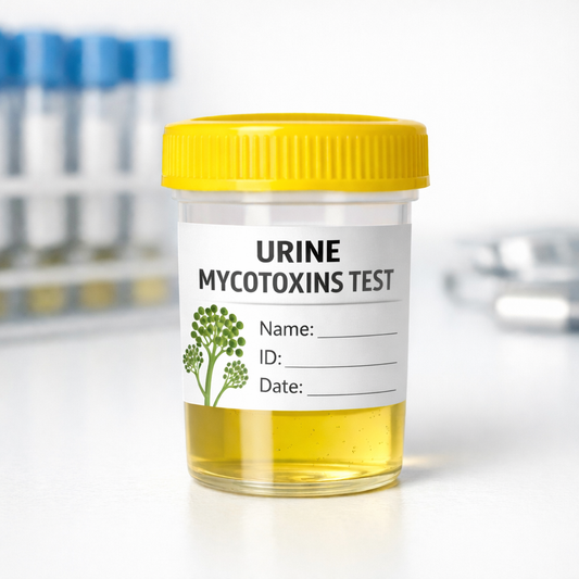 Urine Mycotoxin Test